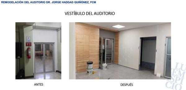vestibulo