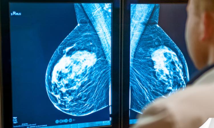 El CDIBIR-UNAH se suma a la lucha contra el cáncer de mama con mamografías a bajo costo