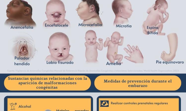 3 de marzo, Día Mundial de los Defectos de Nacimiento.